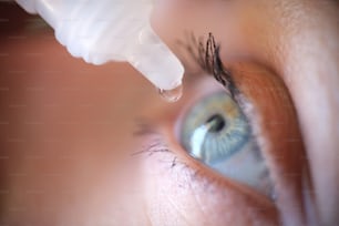 バイアルから滴り落ちる滴が女性の目のクローズアップに。結膜炎治療のコンセプト