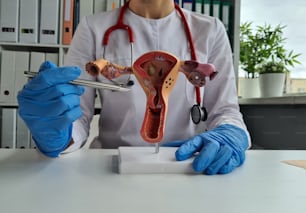 Médico sosteniendo útero ficticio con ovarios en primer plano de la universidad. Examen médico del aparato reproductor femenino