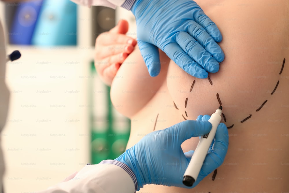 Primo piano delle mani del medico maschio in guanti sterili che disegnano segni sul corpo femminile per la chirurgia plastica