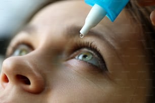 Fêmea colocando gotas de líquido em seu olho resolvendo o problema de visão closeup