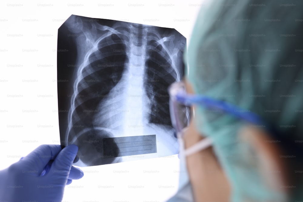 Lo pneumologo in occhiali e maschera guarda la radiografia dei polmoni in clinica. Diagnostica a raggi X delle malattie polmonari durante l'epidemia di infezione da coronavirus.