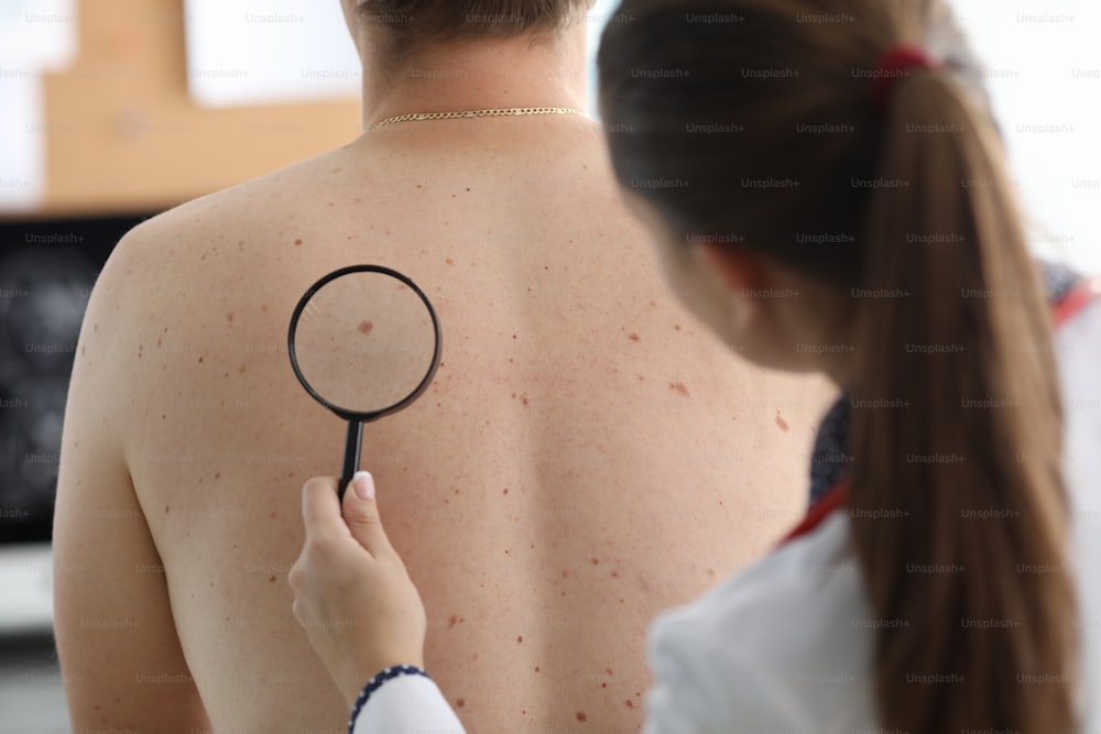 Visão de perto de um jovem dermatologista examinando o melanoma no corpo do paciente. Médica verificando pinta marrom nas costas. Tratamento clínico e conceito de cuidado