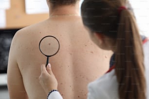 Close-up view of young dermatologist examining melanoma on patients body. Female doctor checking brown mole on back. Clinical treatment and healthcare concept