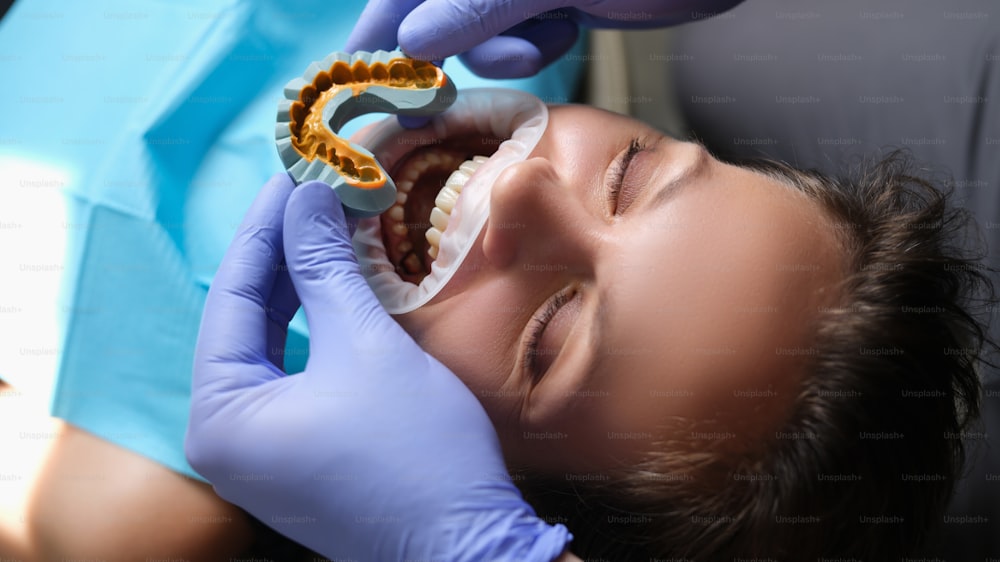 Simulation de dents artificielles sur modèle en plâtre et patient avec la bouche ouverte lors d’un rendez-vous chez le dentiste. Préparation de la mâchoire pour le concept de facettes