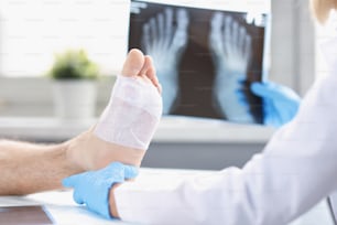 Un medico guarda una radiografia della gamba ferita di un uomo, in primo piano, sfocata. Traumatologo, dolore alla pianta del piede