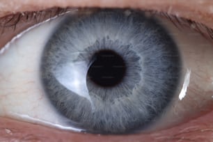 Occhio blu da vicino. Produzione di lenti a contatto colorate. Correzione della vista laser.