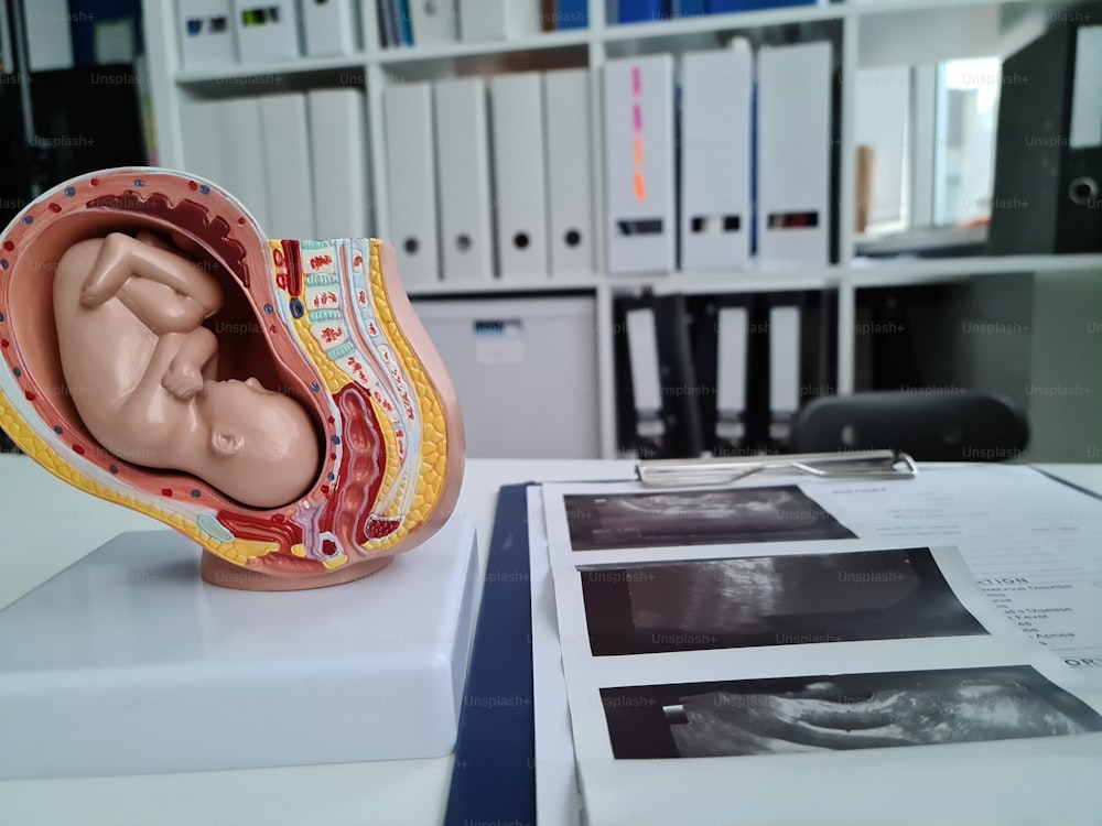 Échographie du bébé fœtus et scanner à rayons X. Concept d’examen médical de la femme enceinte