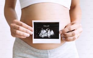 Pregnant woman holding ultrasound baby image. Close-up of pregnant belly and sonogram photo in hands of mother. Concept of pregnancy, gynecology, medical test, maternal health.