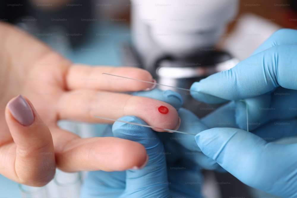 Doctor in protective gloves touching drop of blood on patients hand with specimen slide closeup. Blood sampling concept