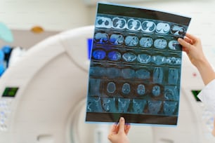 Pesquisa instrumental métodos diagóticos de tomografia computadorizada. Imagem de raio-X nas mãos. TC de fundo