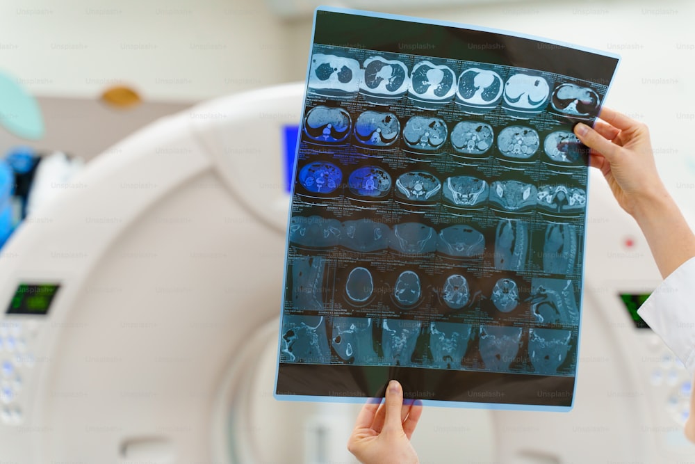 Instrumental research diagostic methods of computer tomography. X-ray picture in hands. CT on background