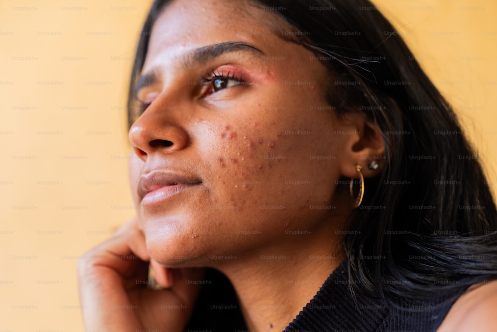 a close up of a woman with freckles on her face