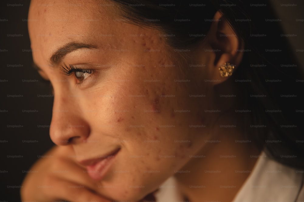 a close up of a person with freckles on her face