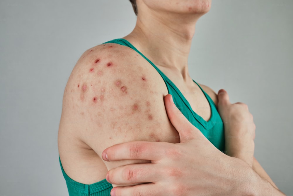 una mujer con el brazo alrededor del hombro