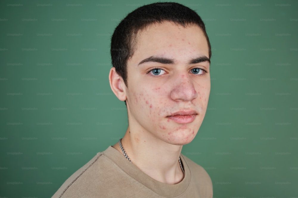 a young man with freckles on his face