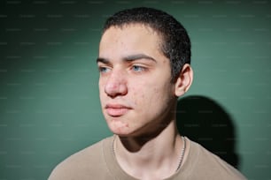 un jeune homme avec des taches de rousseur sur le visage