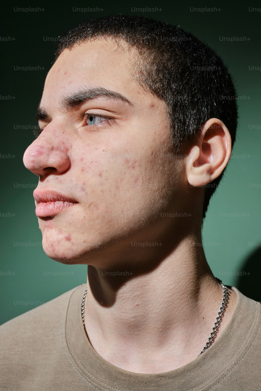 a young man with freckles on his face