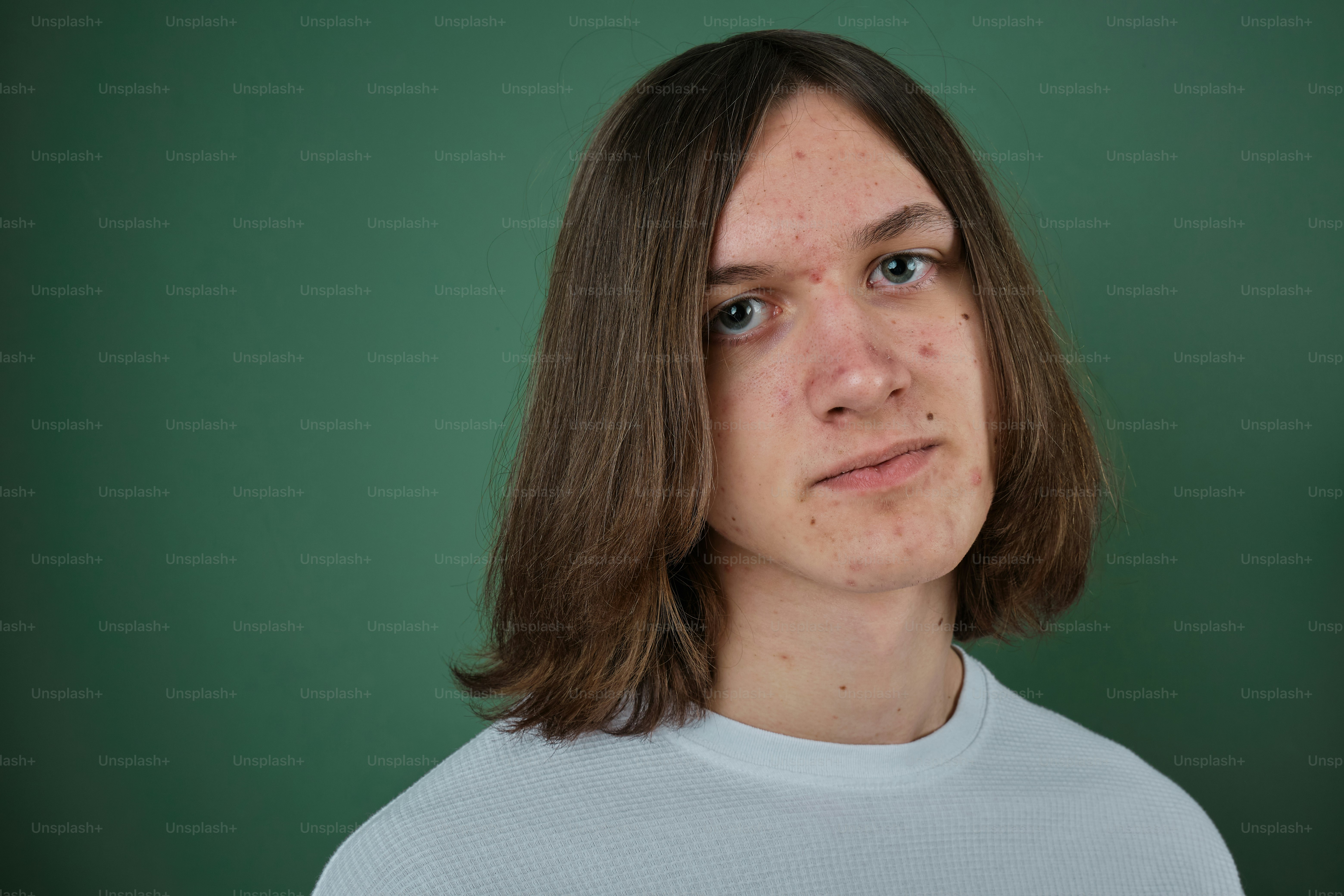 tache de rousseur sur le visage