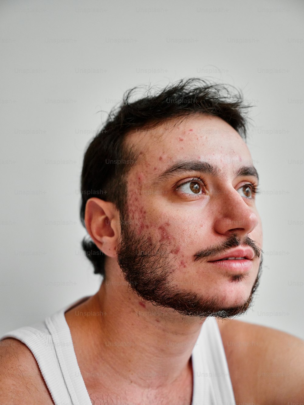 a man with freckles on his face looking up