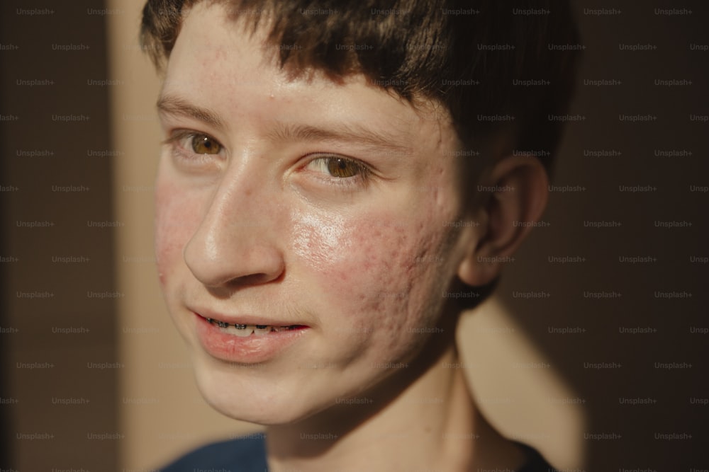 a close up of a person with freckles on their face