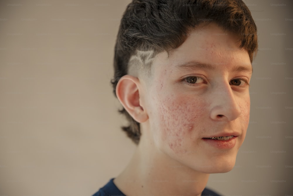 a young boy with freckles on his face