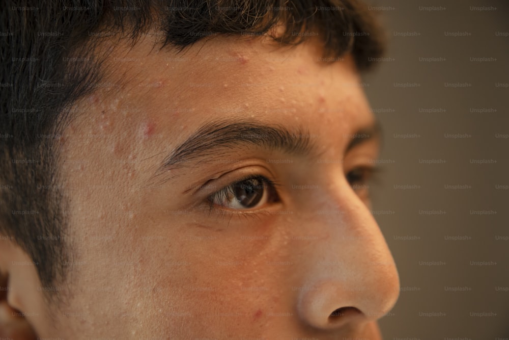 um close up de um homem com sardas no rosto