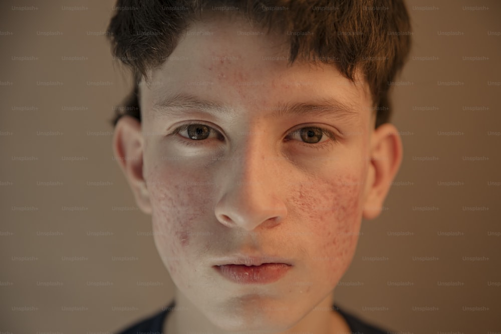 un jeune garçon avec des taches de rousseur sur le visage