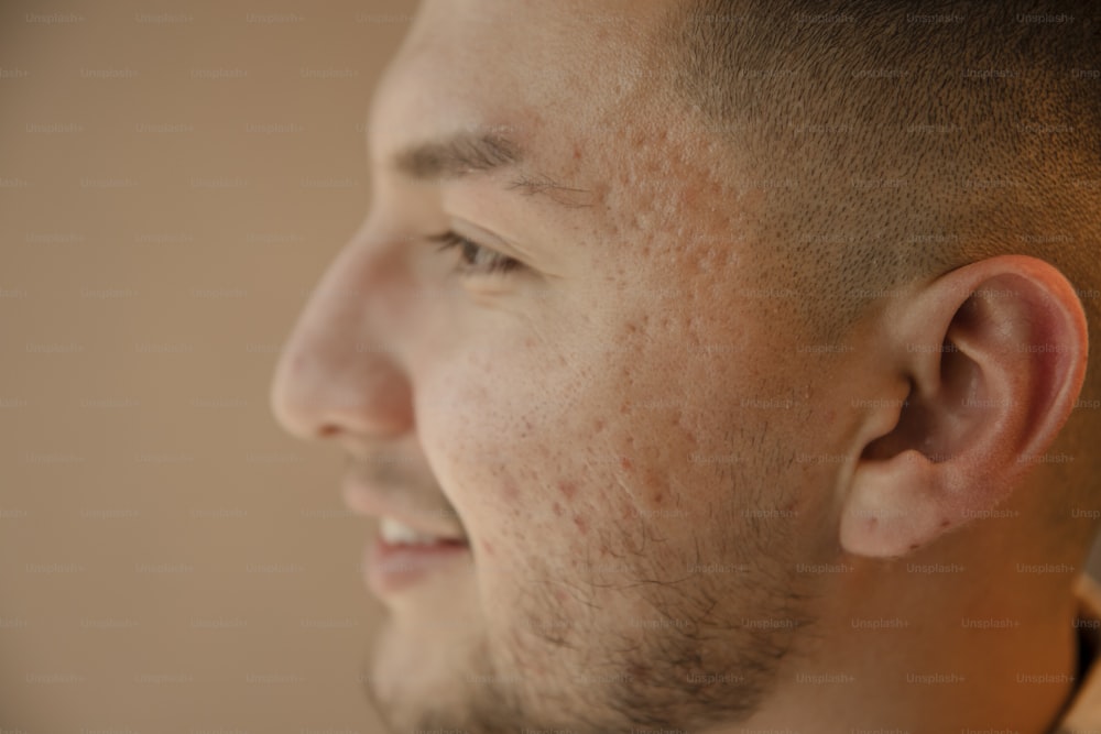 um close up de um homem com sardas no rosto
