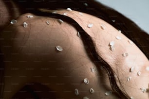 a close up of a woman's back with white dots on her skin