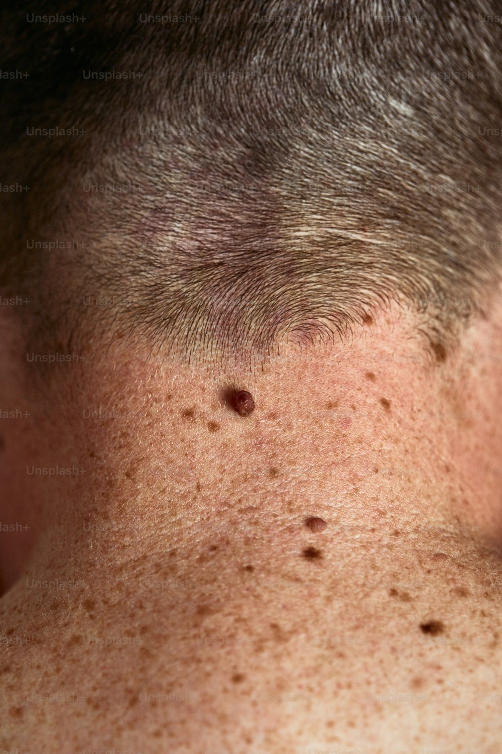 um close up de um homem com sardas nas costas