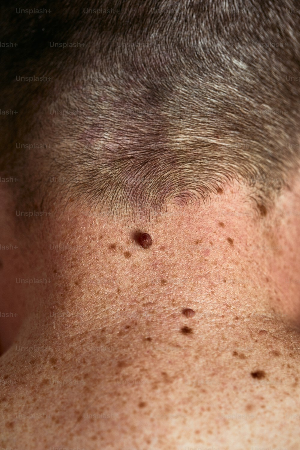 a close up of a man with freckles on his back