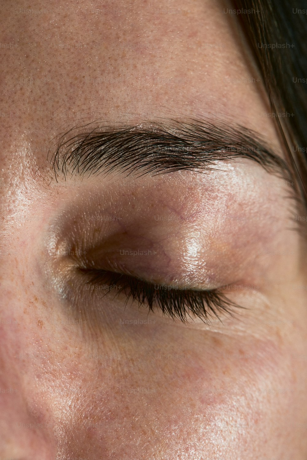 a close up of a person's eye with a brown spot on it
