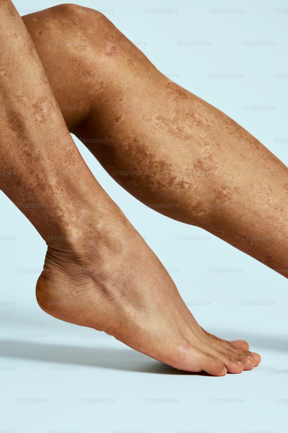 a close up of a person's legs and legs