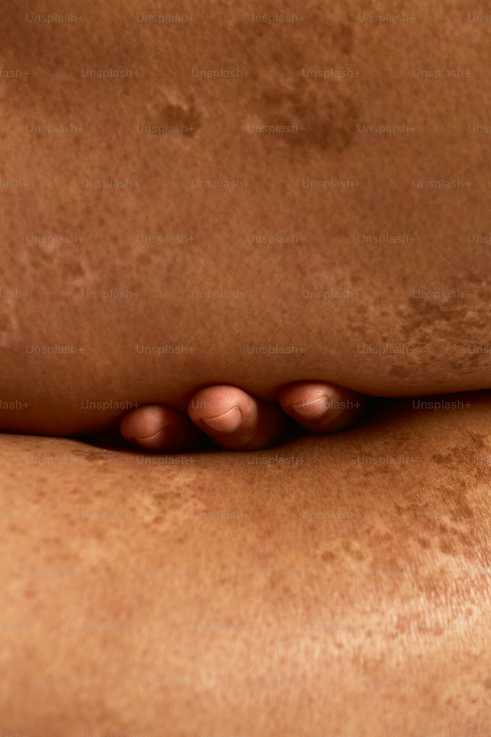 Eine Nahaufnahme des Rückens einer Person mit Akne darauf