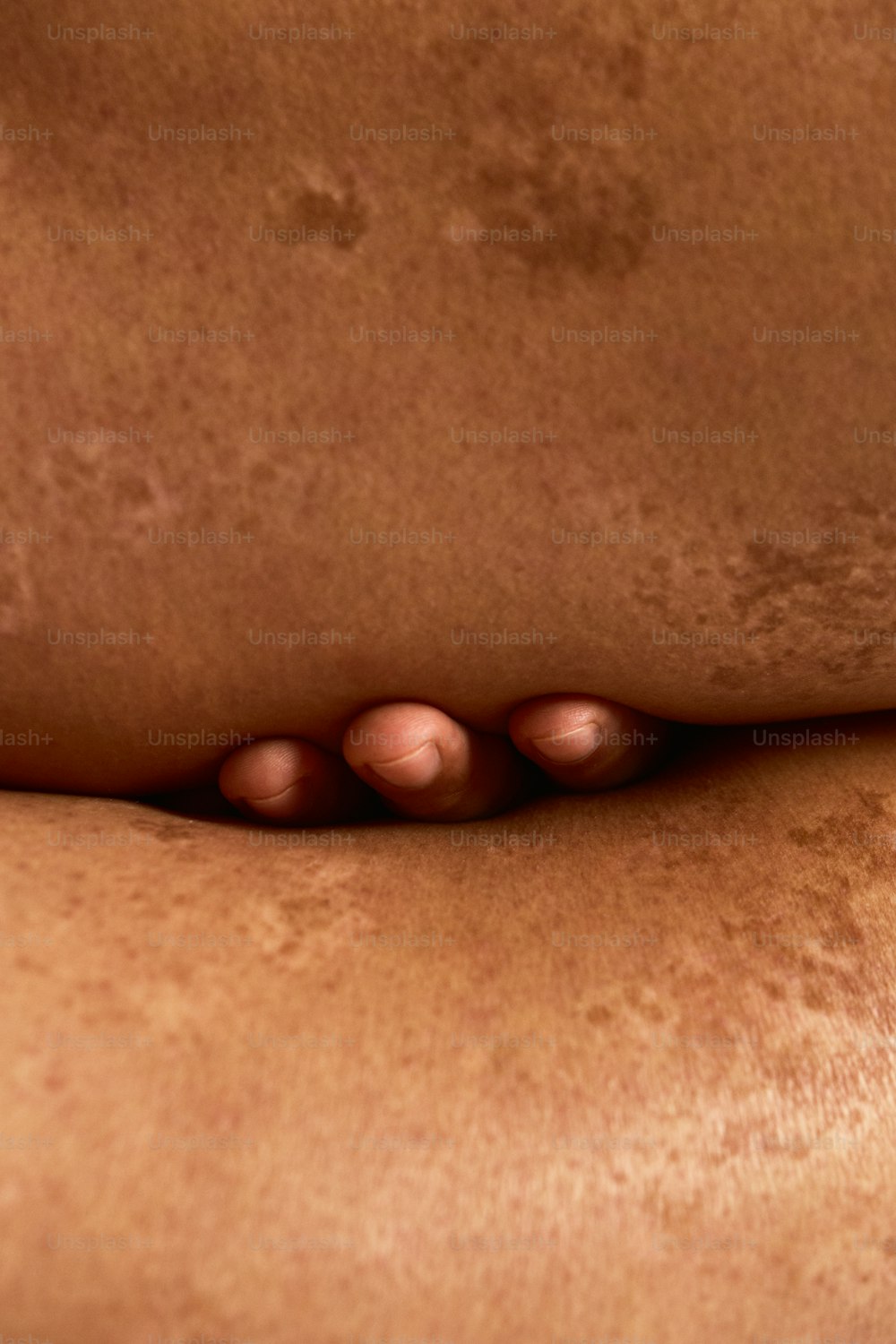 a close up of a person's back with acne on it