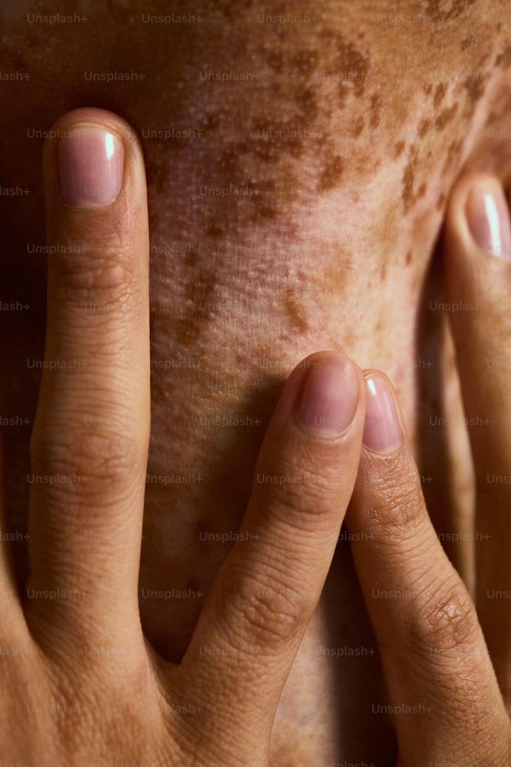 Eine Nahaufnahme der Hände einer Person, die ein Stück Haut hält
