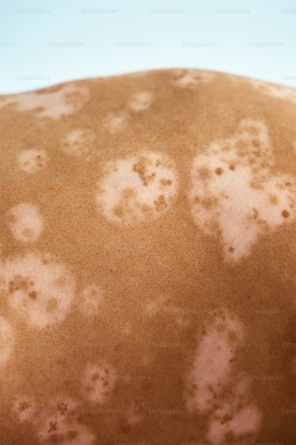 a close up of a person's back with brown spots on it