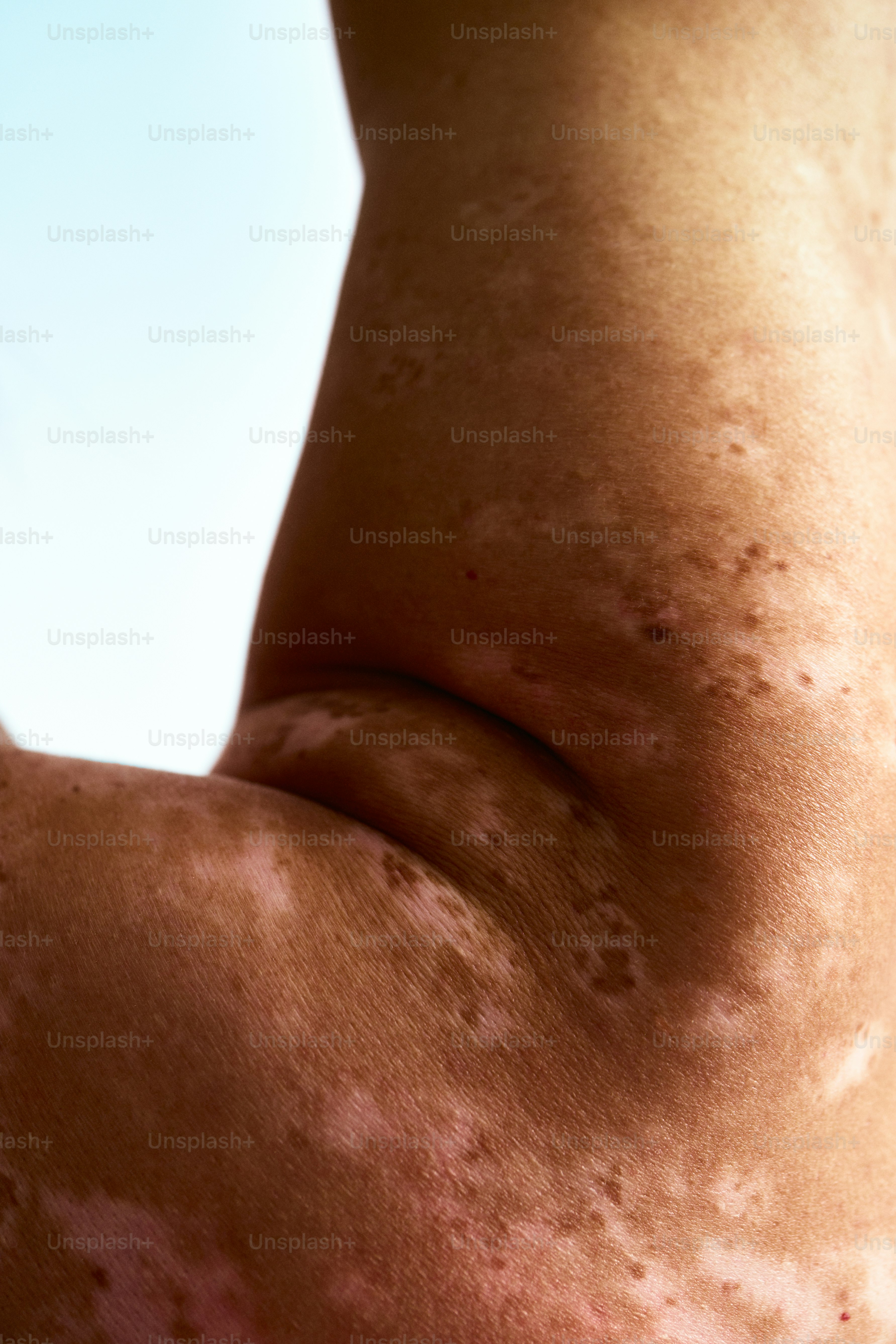 close-up punggung seseorang dengan bintik-bintik di atasnya