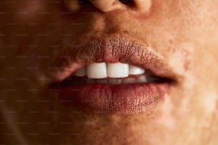 Un primer plano de la boca de una persona con dientes blancos