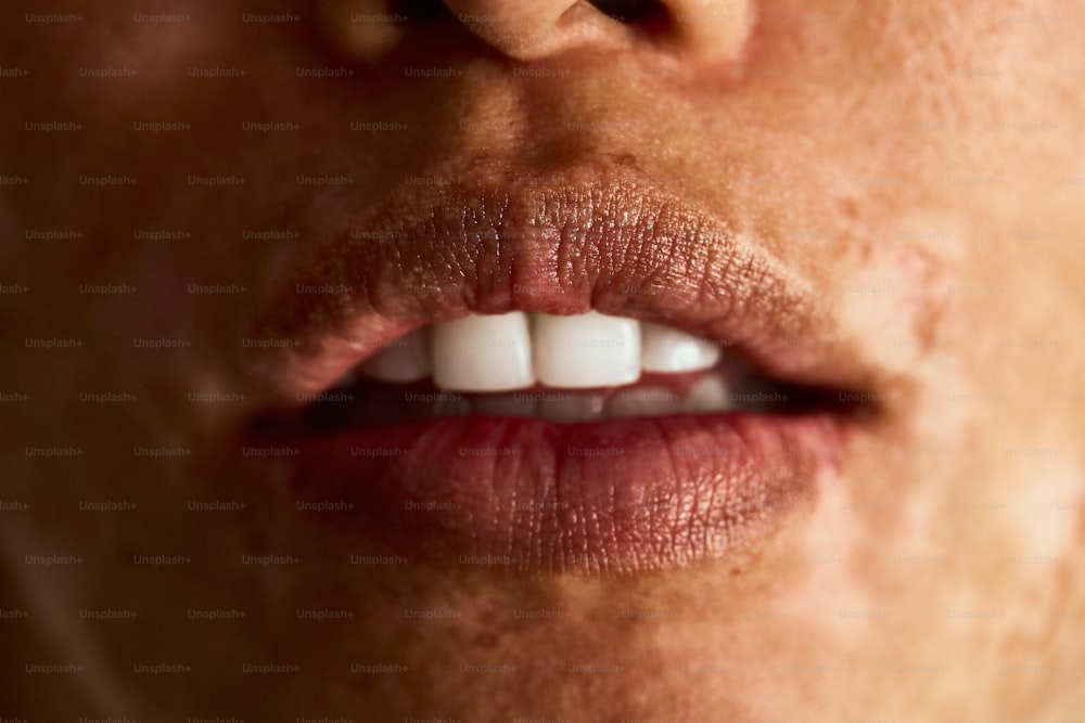 a close up of a person's mouth with white teeth