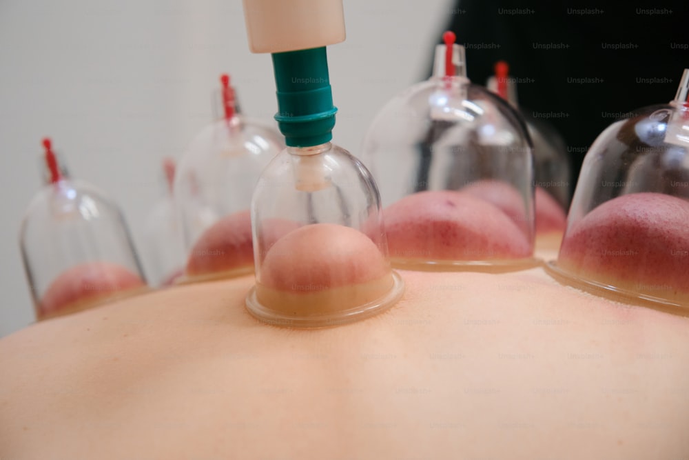 a woman with her back turned to the side with several small bottles on top of