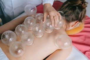 a woman getting cuppings on her back