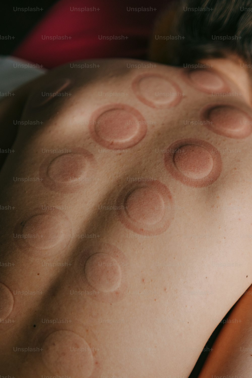 a man laying in bed with a lot of circles on his back