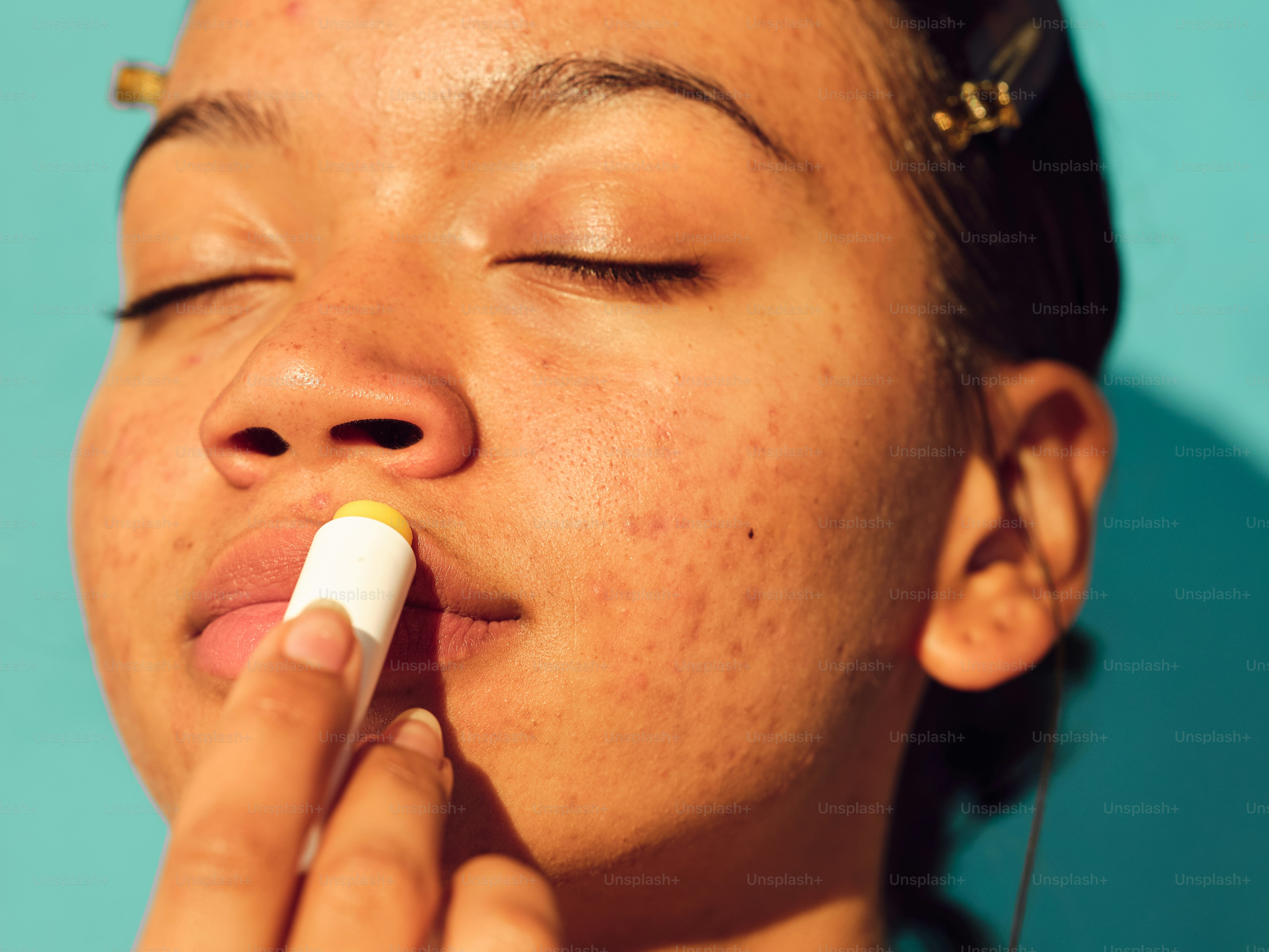 a woman with freckles on her face is using a lip bale