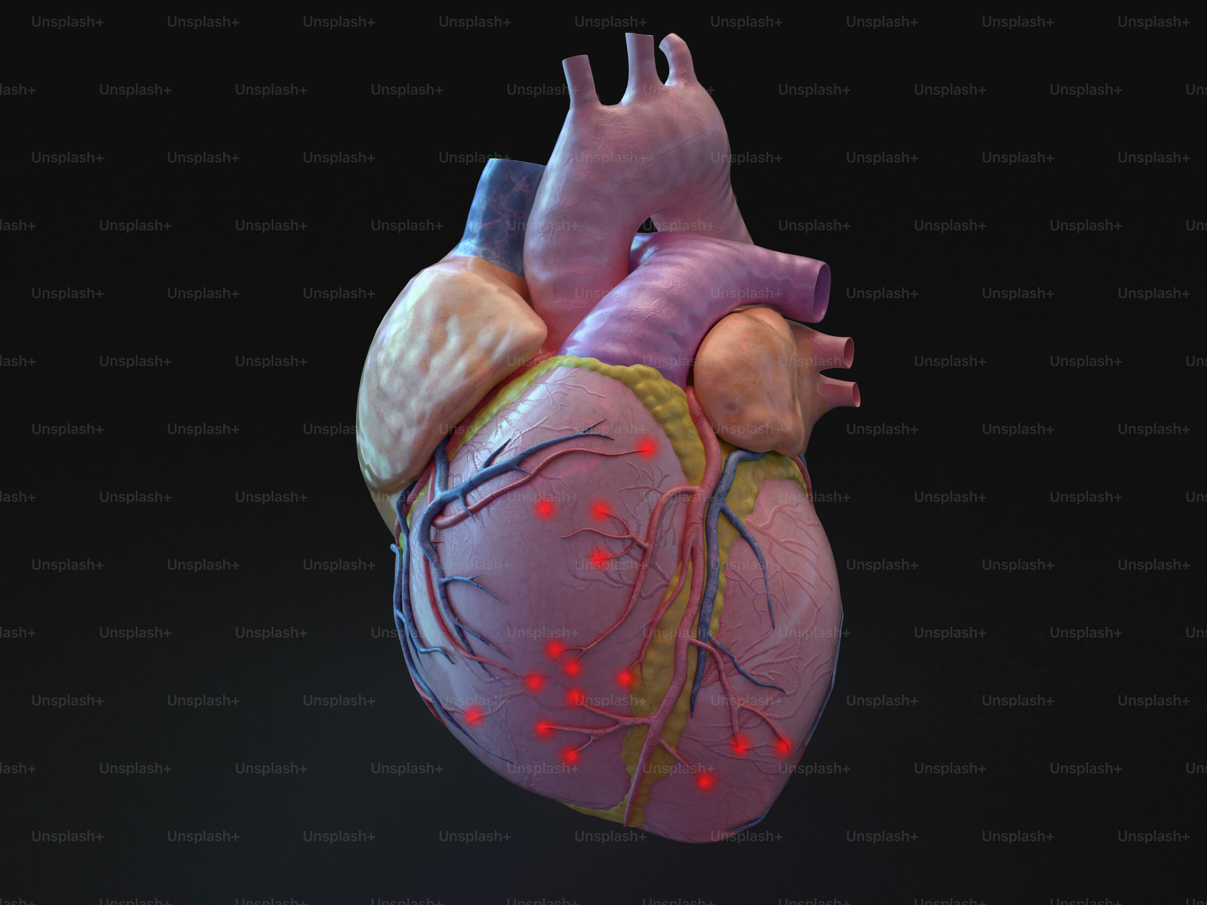 inter ventricular artery