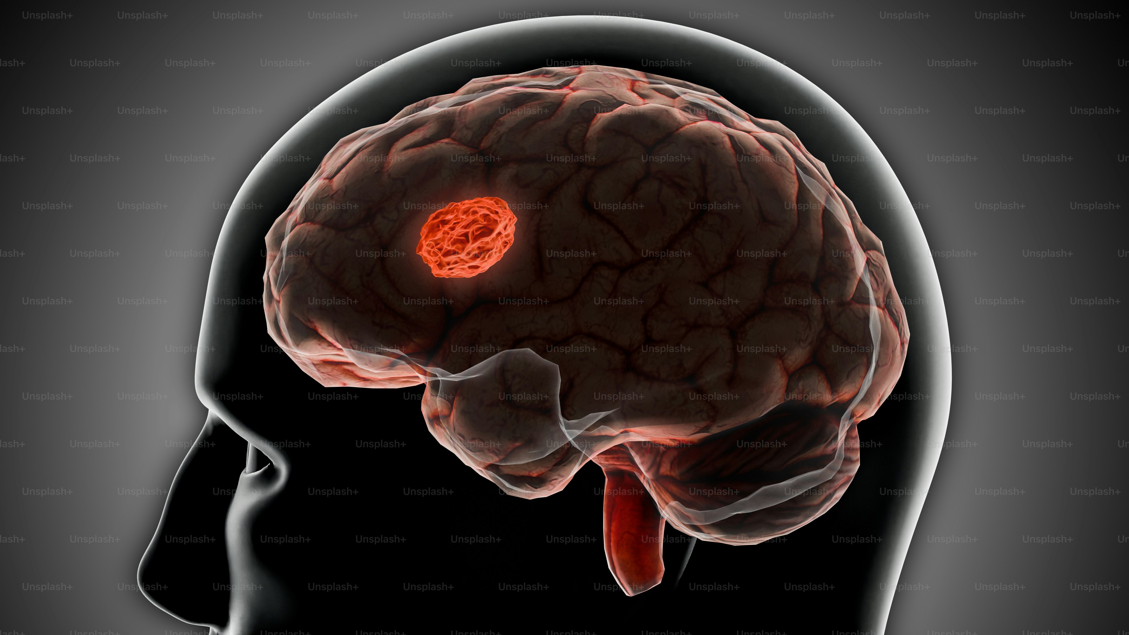 una testa umana con il cervello evidenziato in rosso