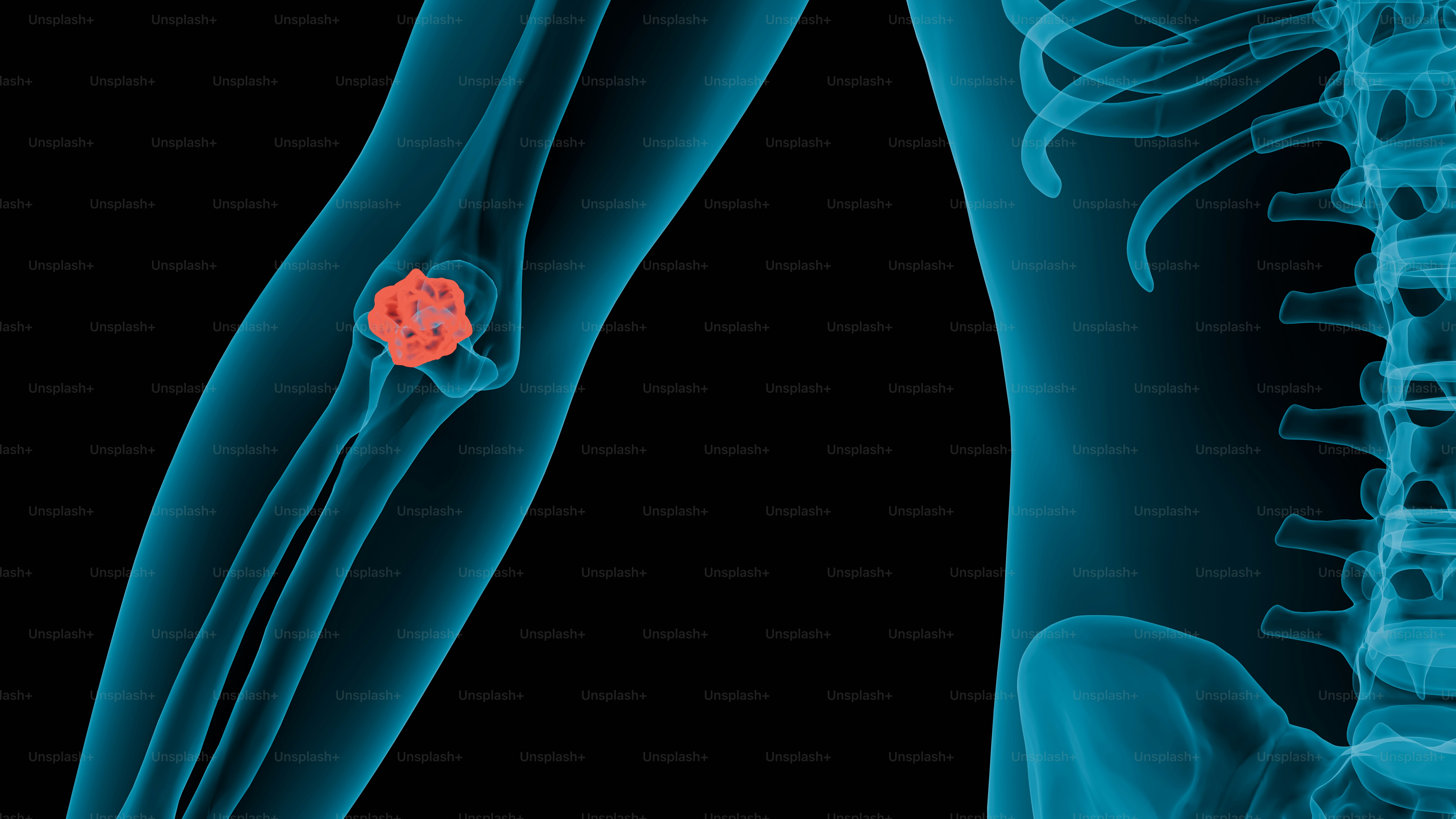 a picture of a red ball in the back of a skeleton