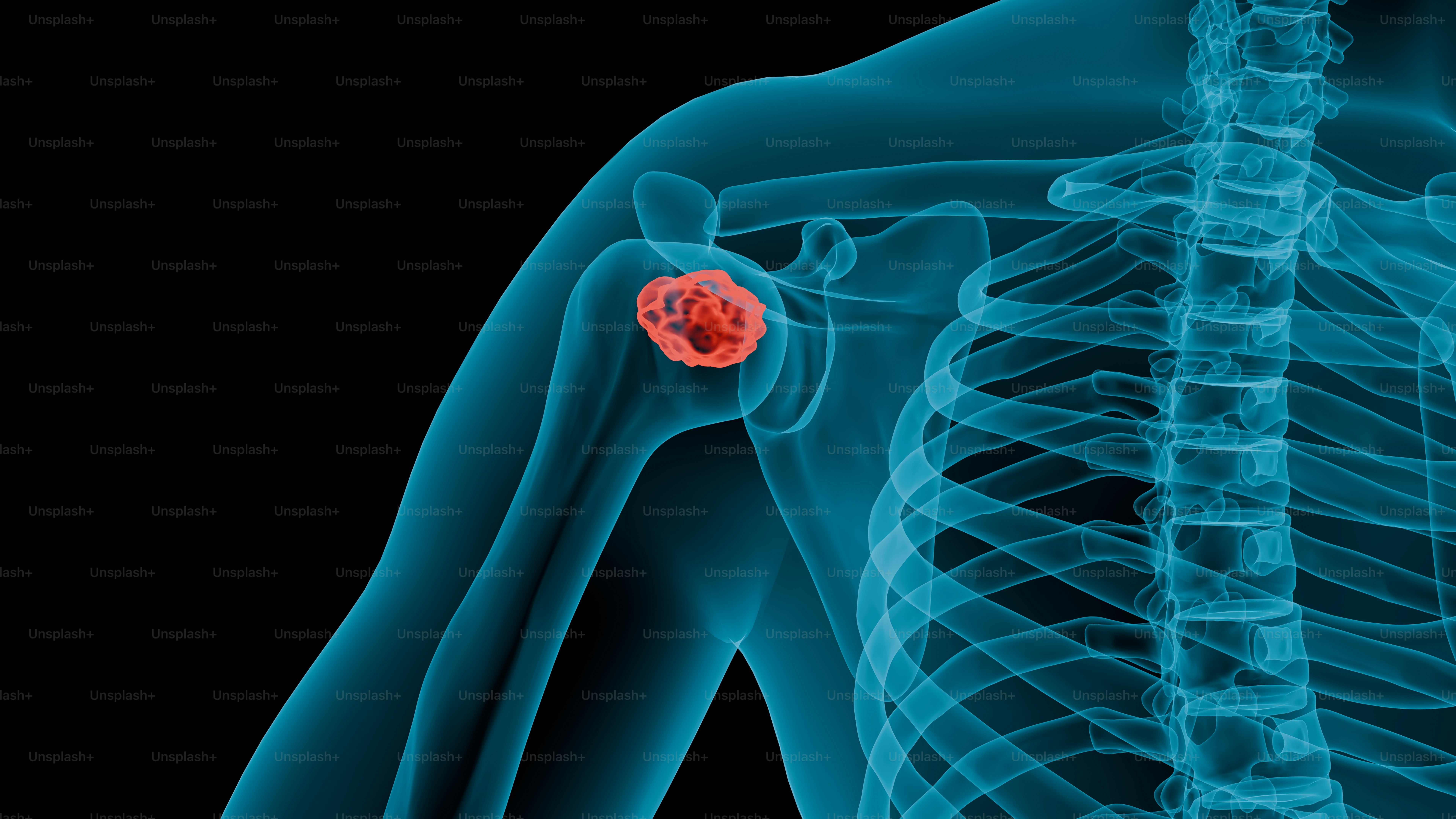 a picture of a skeleton with a red ball in it's shoulder