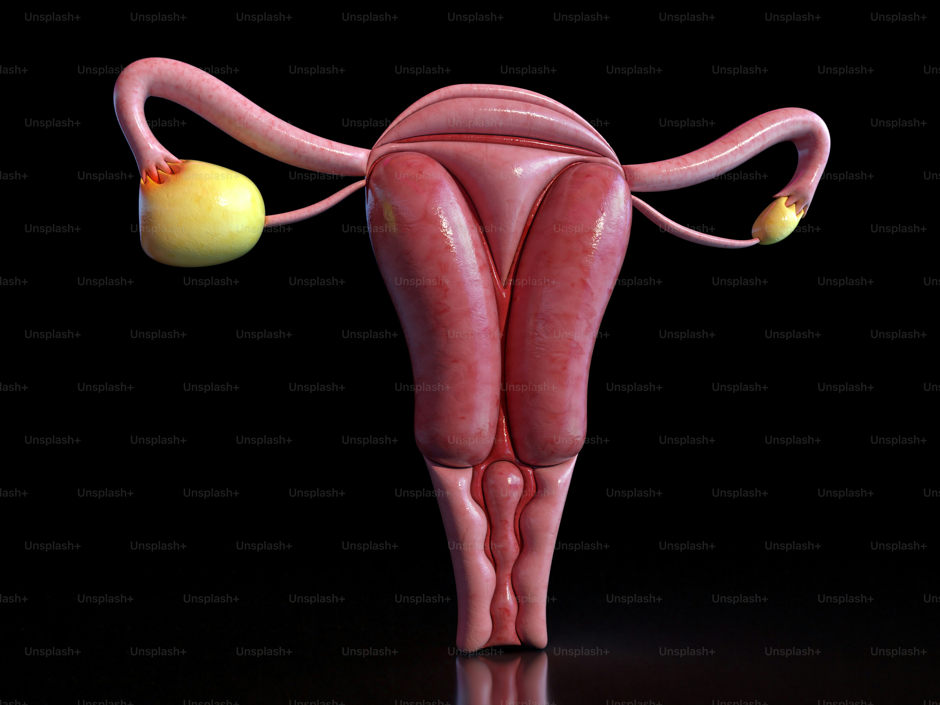 cancerous ovary