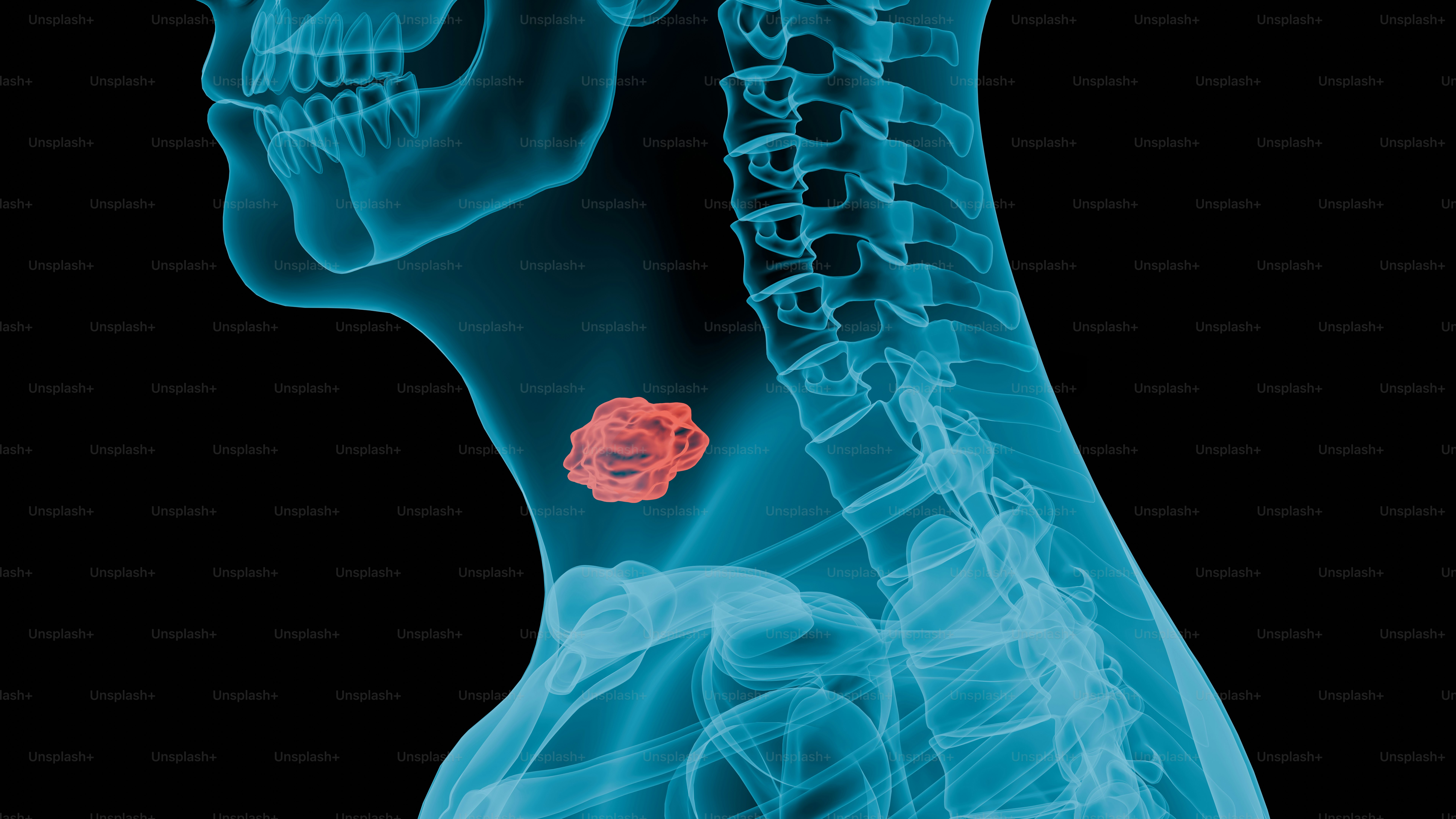 Imagens de Câncer De Tireoide | Baixe imagens gratuitas na Unsplash, image size:3000x1688